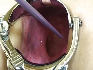 AnalMom - Candice Dare You Get An Honey